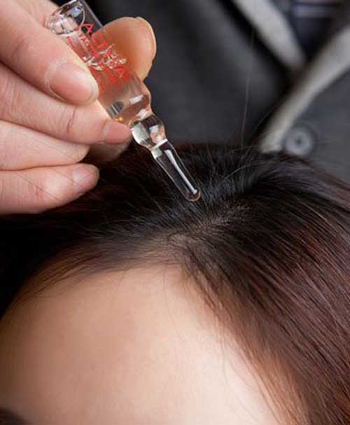 Scalp-Treatments